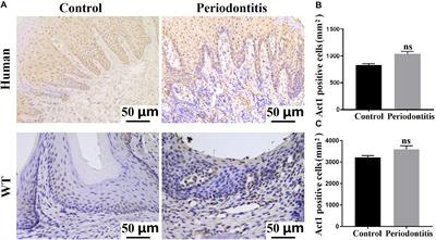 Downregulation of Macrophage-Specific Act-1 Intensifies Periodontitis and Alveolar Bone Loss Possibly via TNF/NF-κB Signaling